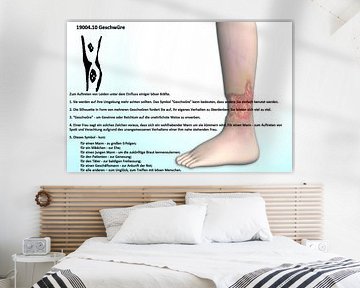 Ulcers 19004.10