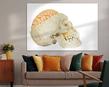 Human skull with artificial brains sur Ben Schonewille