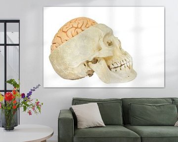 Menselijke schedel met hersenen van Ben Schonewille